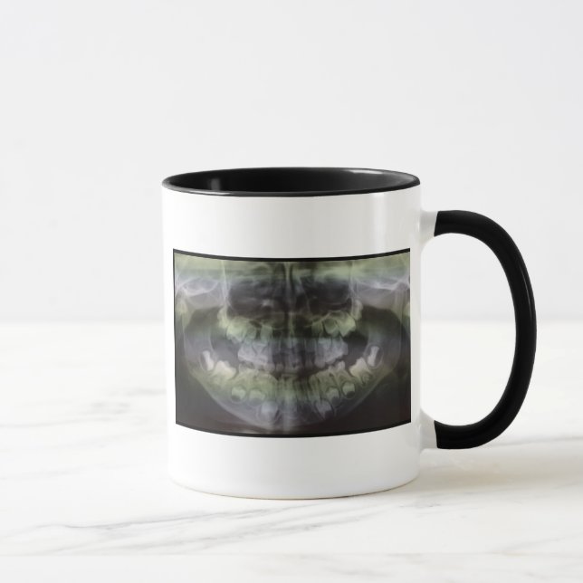 OPG Coffee Mug (Right)
