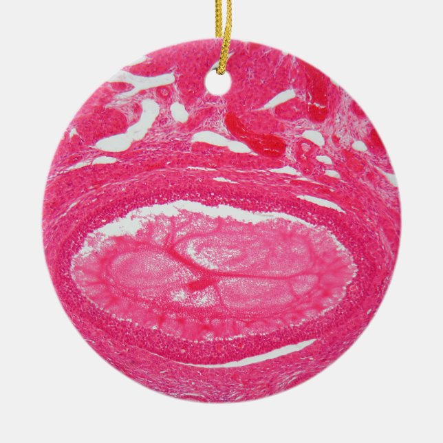 Ovary cells under the microscope. ceramic tree decoration (Front)