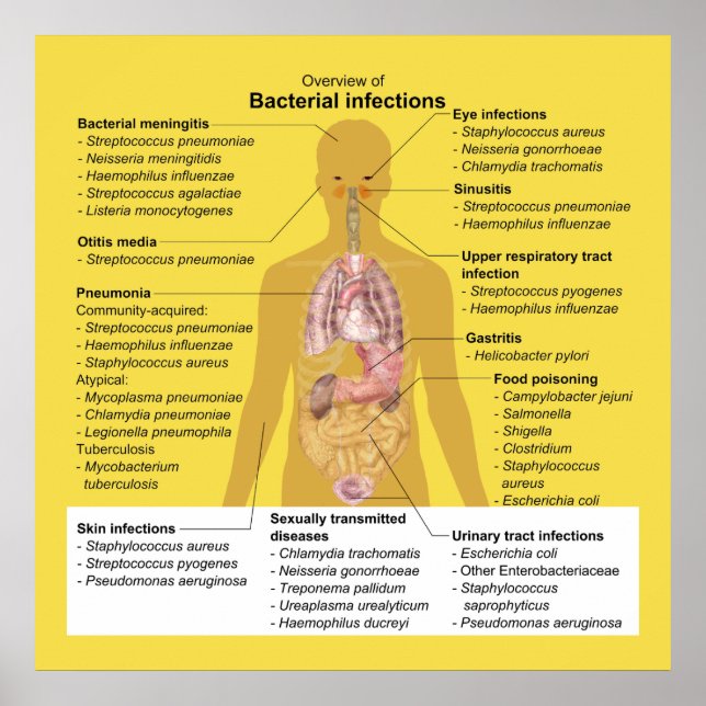 Overview of Bacterial Infections Poster (Front)