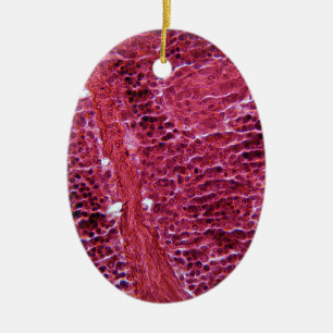 Pancreas Cells under the Microscope Ceramic Tree Decoration