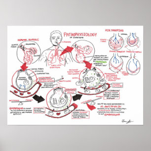 Pathophysiology of Emphysema Poster
