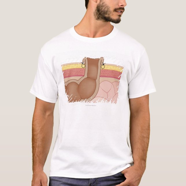 Permanent Colostomy T-Shirt (Front)