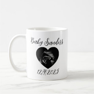 Personalised Baby Sonogram Mug – Custom Ultrasound