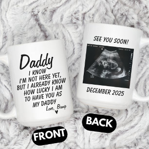 Personalised Sonogram Photo, Ultrasound Photo Baby Coffee Mug