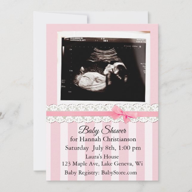 Personalised Ultrasound Baby Shower Invitations (Front)