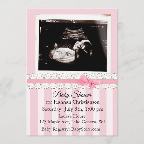 Ultrasound Invitations | Zazzle AU