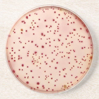 Petri dish coaster