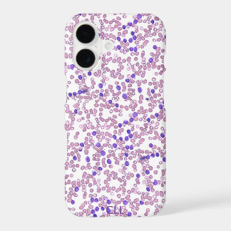 Phone case(many models)-Chronic Lymphomic Leukemia
