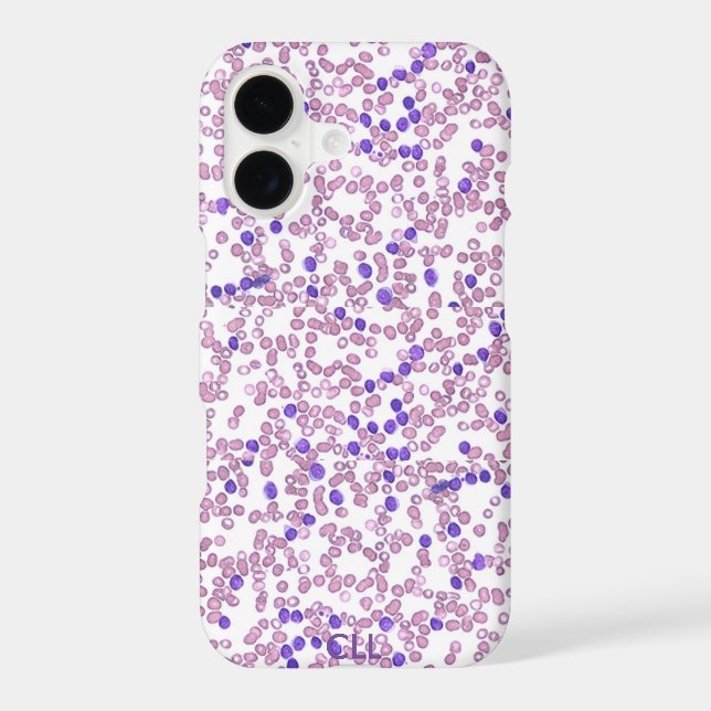 Phone case(many models)-Chronic Lymphomic Leukemia (Back)