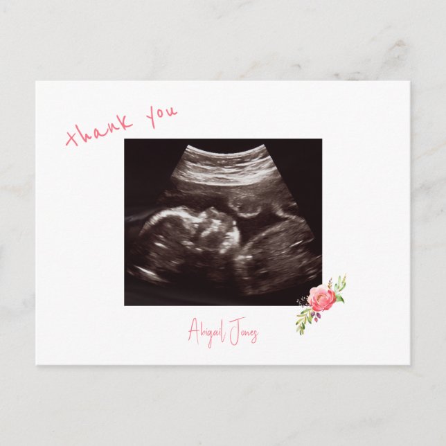  Pink Baby Shower Ultrasound Cute Font Thank You Postcard (Front)