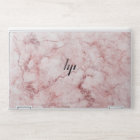 Pink Marble HP Laptop Skin