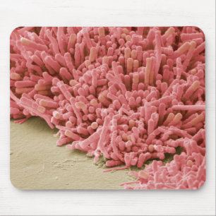Plaque-forming bacteria, coloured scanning mouse pad