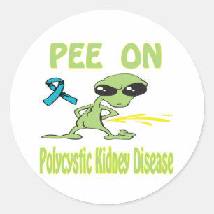 Polycystic Kidney Disease Classic Round Sticker