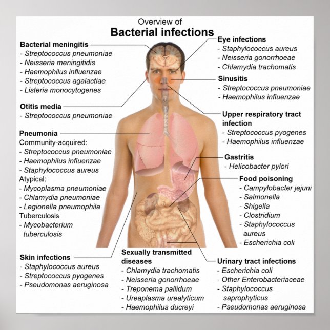 Poster Chart of bacterial infections in Humans  (Front)