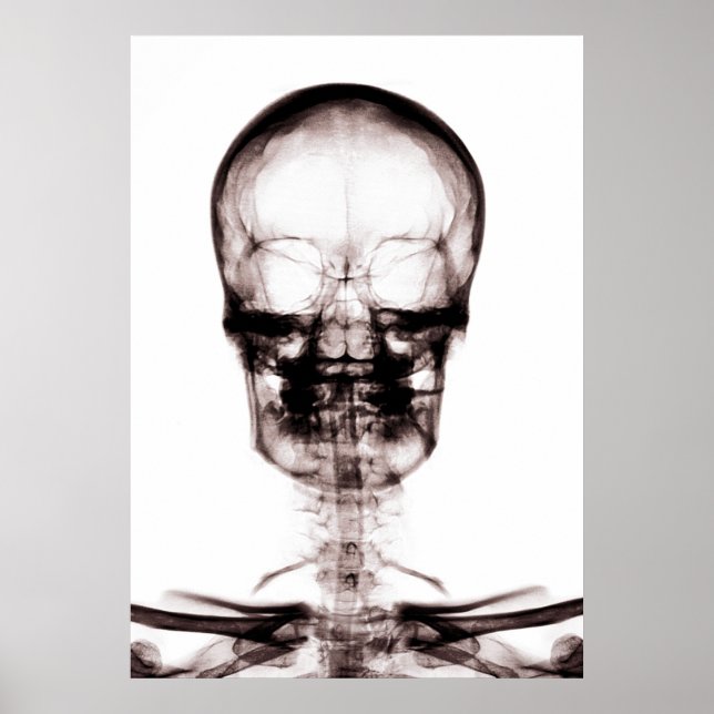POSTER/PRINT X-RAY VISION SKELETON SKULL ORIG/NEG POSTER (Front)
