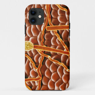 Powdery Mildew Fungus on Poinsettia iPhone 11 Case