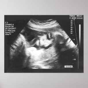 Prank Fake Ultrasound Picture Poster