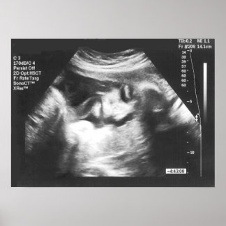 Prank Fake Ultrasound Picture Poster