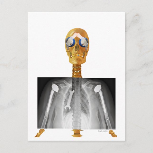 Pre-addressed Postcard to Trump re Trumpcare (Front)