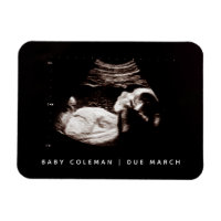 Pregnancy Announcement Baby Sonogram Photo