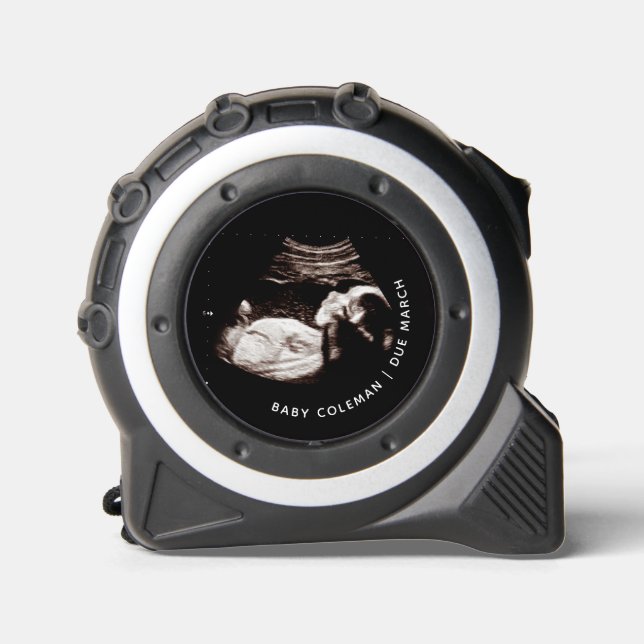 Pregnancy Announcement Sonogram 1 (Front)