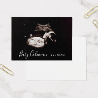 Pregnancy Announcement Sonogram Mini Card
