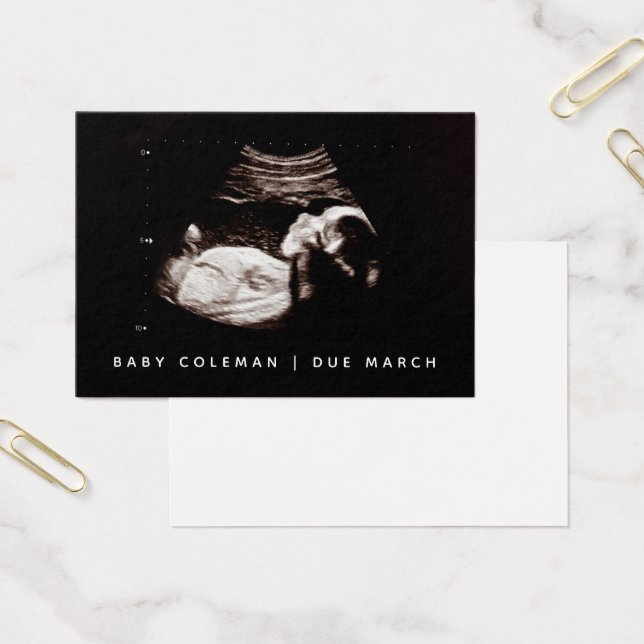 Pregnancy Announcement Sonogram Mini Card Pack (Office)