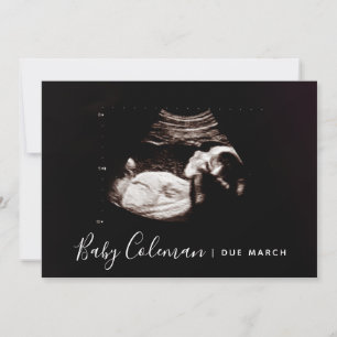 Pregnancy Announcement Sonogram Script Name Card