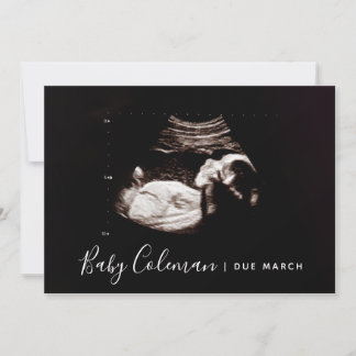 Pregnancy Announcement Sonogram Script Name Card
