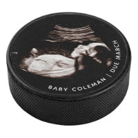 Pregnancy Baby Sonogram Ultrasound Photo