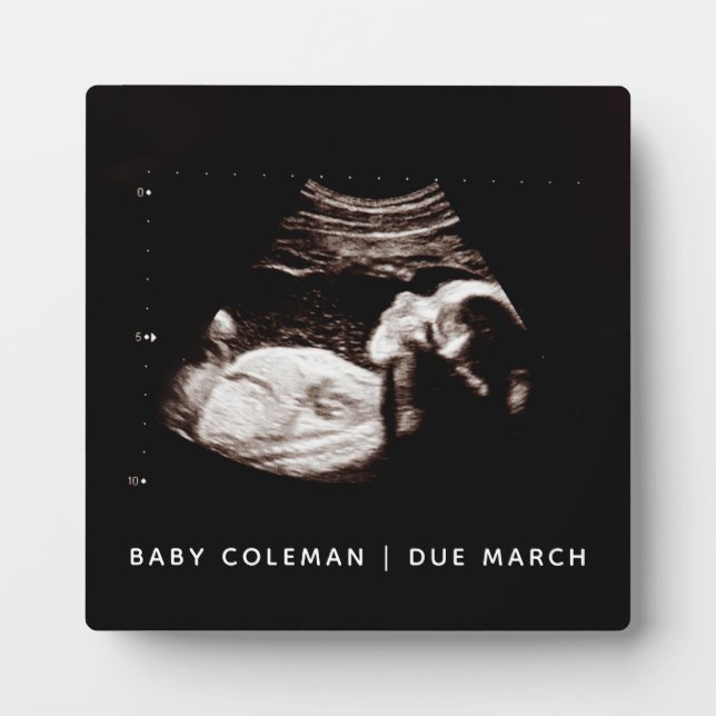 Pregnancy Baby Sonogram Ultrasound Photo New Mom Plaque (Front)