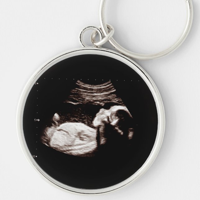 Pregnancy Baby Sonogram Ultrasound Photo New Mum Key Ring (Front)