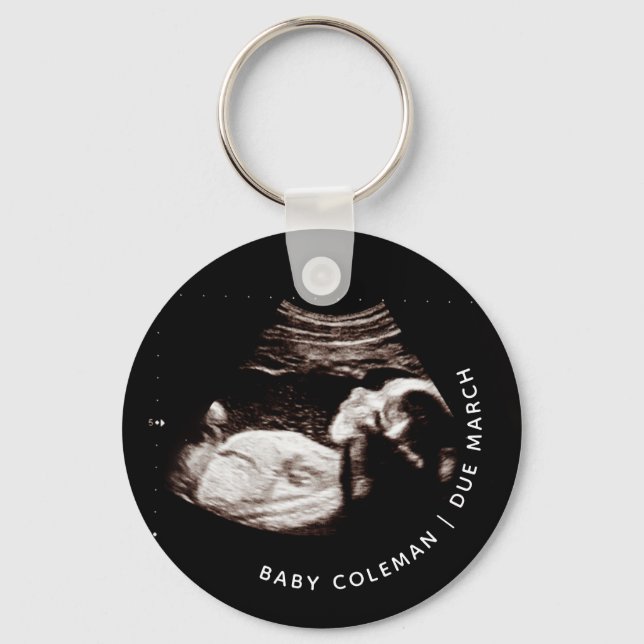 Pregnancy Baby Sonogram Ultrasound Photo New Mum Key Ring (Front)