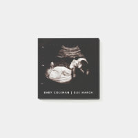 Pregnancy Baby Sonogram Ultrasound Photo
