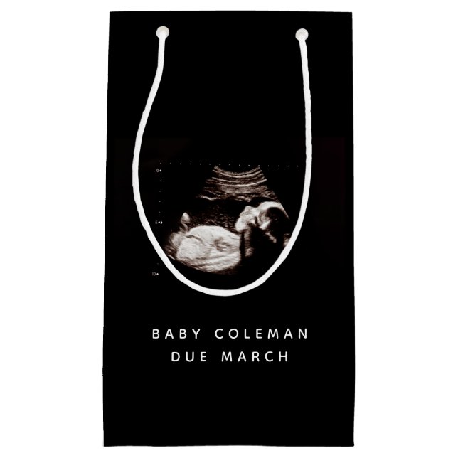 Pregnancy Baby Sonogram Ultrasound Photo Small Gift Bag (Front)