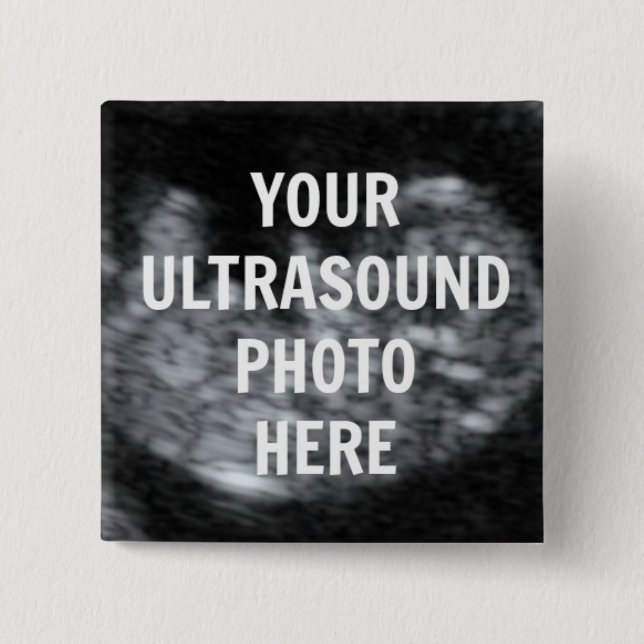 Pregnancy Ultrasound Keepsake 15 Cm Square Badge (Front)