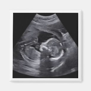 Pregnant Sonogram Photo Timeless Keepsake fun Magnet