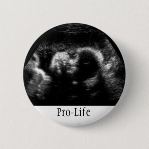 Pro-Life 6 Cm Round Badge