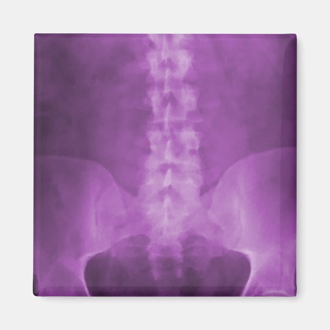 Purple Digital X-Ray Art Magnet (Front)