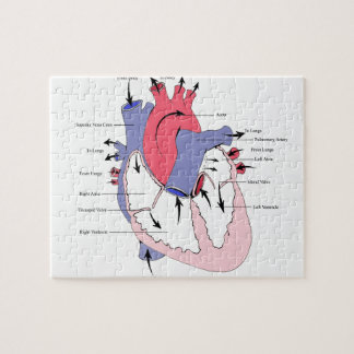 Puzzle - Customised