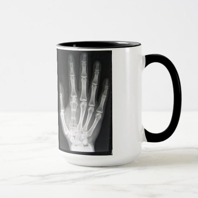Queen in the Hand X-ray Mug (Right)