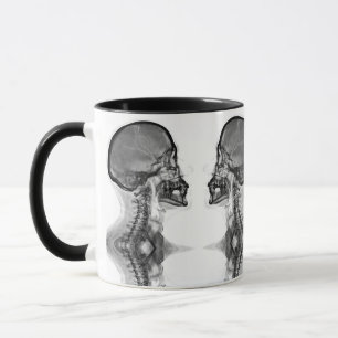 Radiological mug