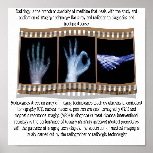 RADIOLOGY - XRAY POSTER - HAND, OK, HANDSHAKE (Front)
