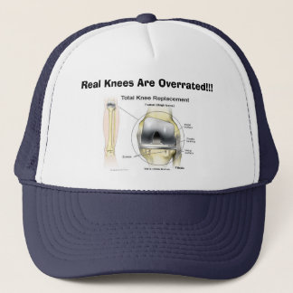 Real Knees Are Overrated!!! Trucker Hat