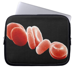 Red Blood Cells Laptop Sleeve