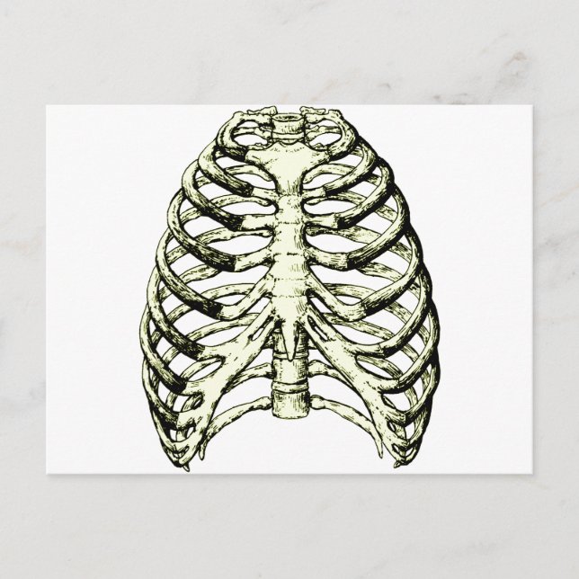 Rib Cage Bronze Postcard (Front)