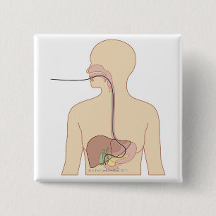Route of Endoscope 15 Cm Square Badge