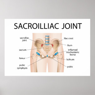 Sacroilliac joint poster