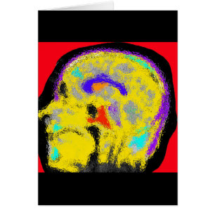 sagital MRI
