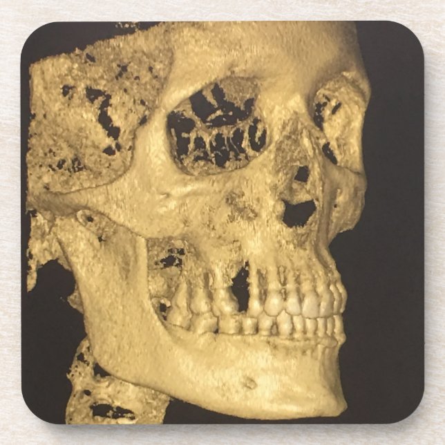 Scary Skull Coaster (Front)